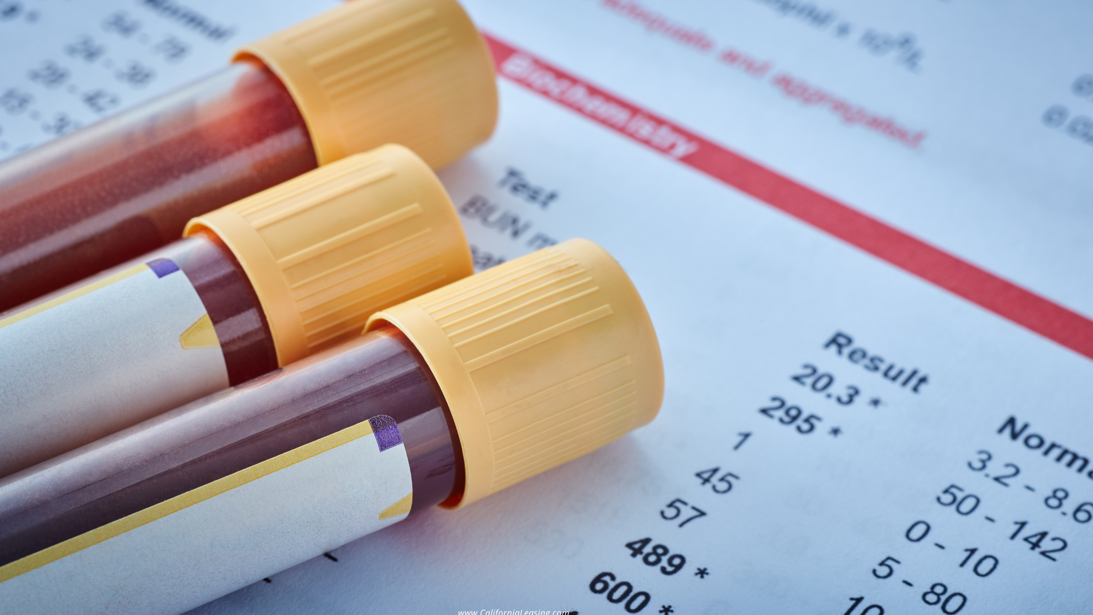 The Convenience of At-Home Blood Panels